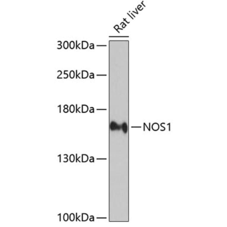 Western Blot - Anti-nNOS (neuronal) Antibody (A13467) - Antibodies.com