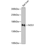 Western Blot - Anti-nNOS (neuronal) Antibody (A13467) - Antibodies.com
