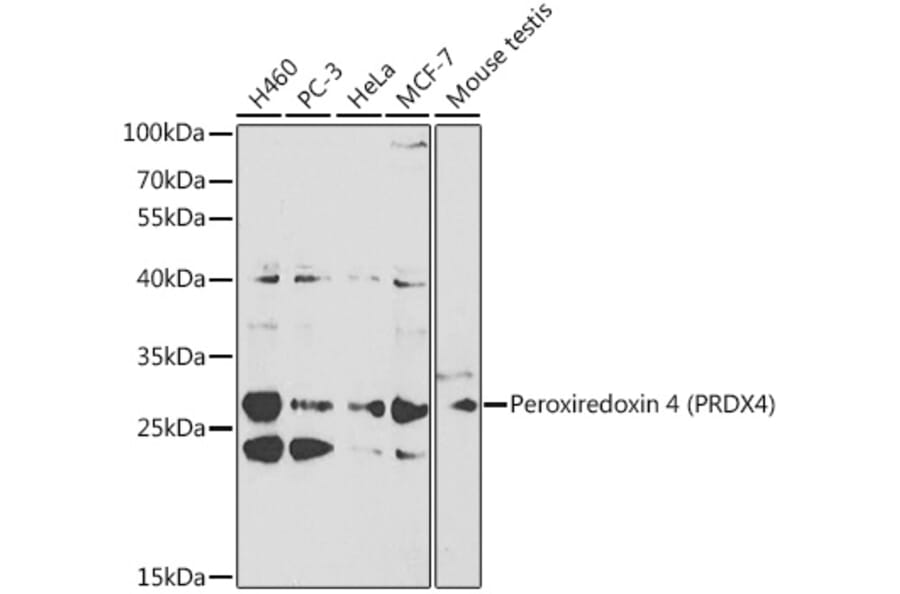 Western Blot - Anti-Peroxiredoxin 4 Antibody (A13468) - Antibodies.com