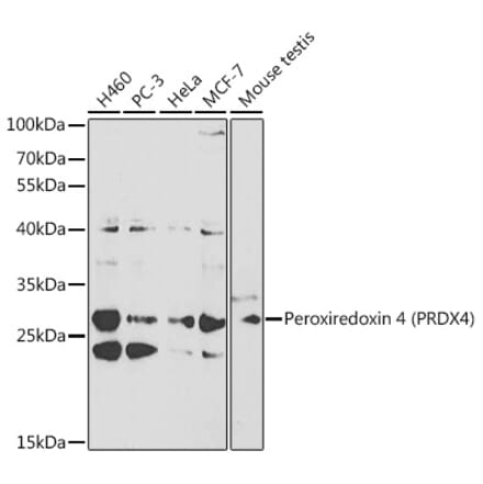 Western Blot - Anti-Peroxiredoxin 4 Antibody (A13468) - Antibodies.com