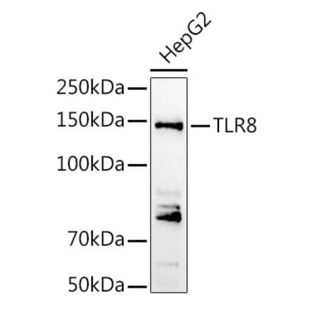 Western Blot - Anti-TLR8 Antibody (A13469) - Antibodies.com