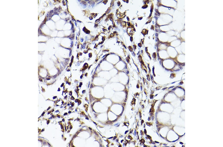 Immunohistochemistry - Anti-TLR8 Antibody (A13469) - Antibodies.com