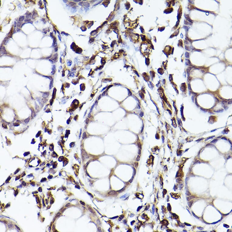 Immunohistochemistry - Anti-TLR8 Antibody (A13469) - Antibodies.com
