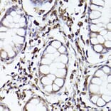 Immunohistochemistry - Anti-TLR8 Antibody (A13469) - Antibodies.com