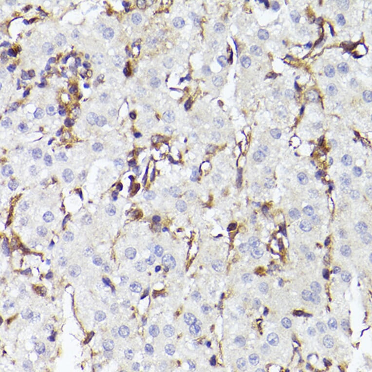 Immunohistochemistry - Anti-TLR8 Antibody (A13469) - Antibodies.com