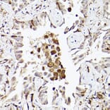 Immunohistochemistry - Anti-TLR8 Antibody (A13469) - Antibodies.com