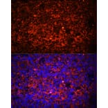 Immunofluorescence - Anti-TLR8 Antibody (A13469) - Antibodies.com