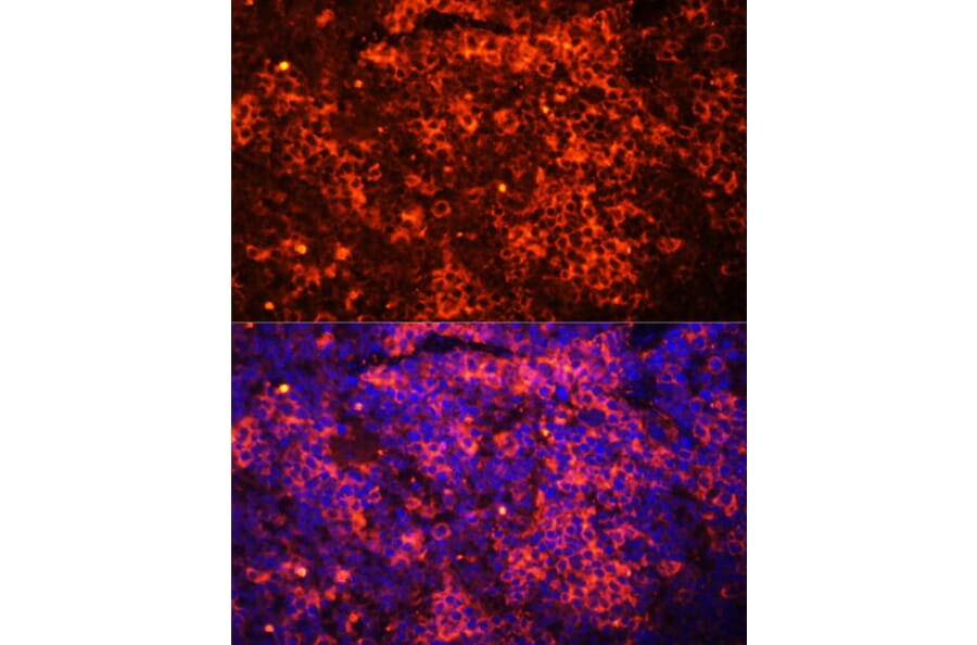 Immunofluorescence - Anti-TLR8 Antibody (A13469) - Antibodies.com