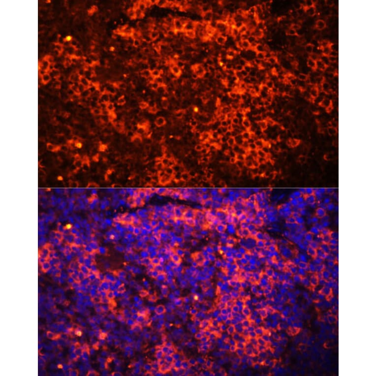 Immunofluorescence - Anti-TLR8 Antibody (A13469) - Antibodies.com