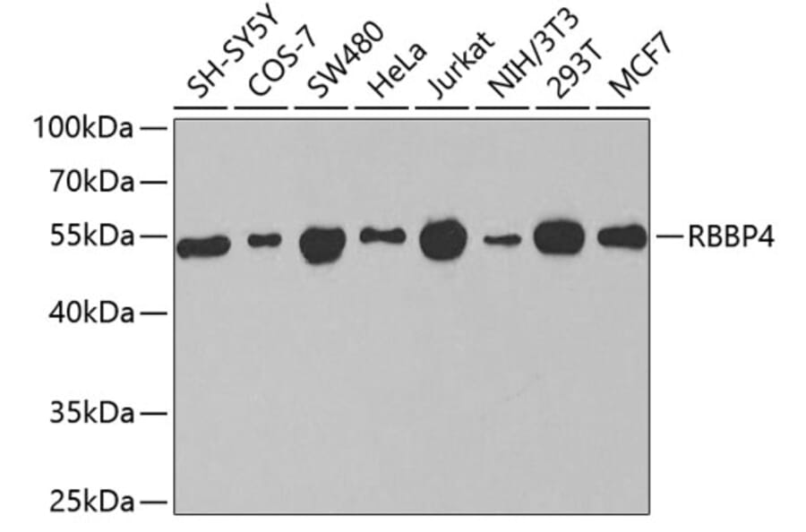 Western Blot - Anti-RBBP4 Antibody (A1490) - Antibodies.com