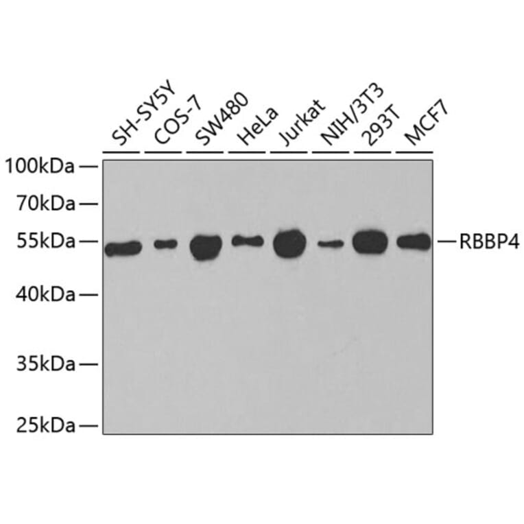 Western Blot - Anti-RBBP4 Antibody (A1490) - Antibodies.com