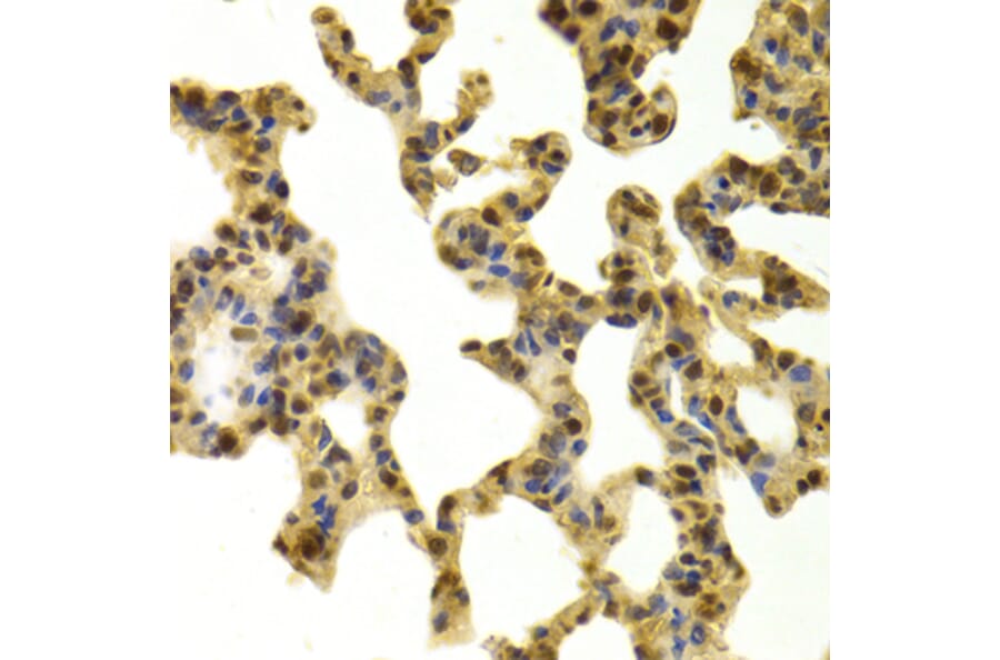 Immunohistochemistry - Anti-RBBP4 Antibody (A1490) - Antibodies.com