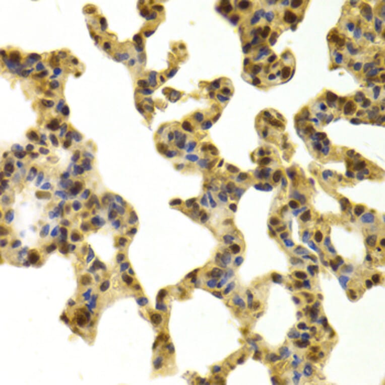 Immunohistochemistry - Anti-RBBP4 Antibody (A1490) - Antibodies.com