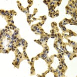 Immunohistochemistry - Anti-RBBP4 Antibody (A1490) - Antibodies.com