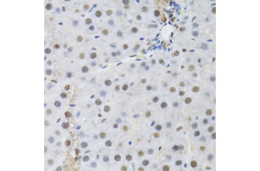 Immunohistochemistry - Anti-RBBP4 Antibody (A1490) - Antibodies.com