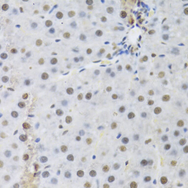 Immunohistochemistry - Anti-RBBP4 Antibody (A1490) - Antibodies.com