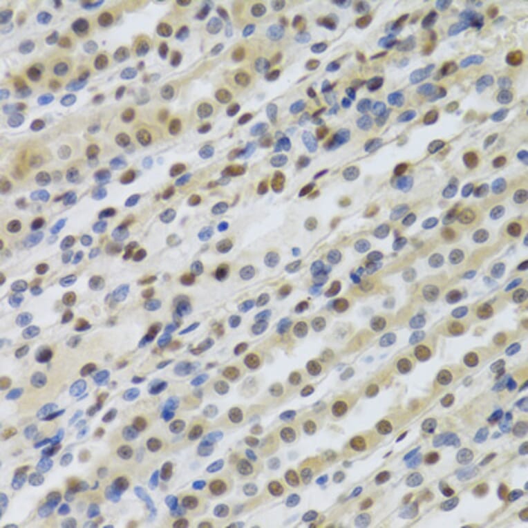 Immunohistochemistry - Anti-RBBP4 Antibody (A1490) - Antibodies.com