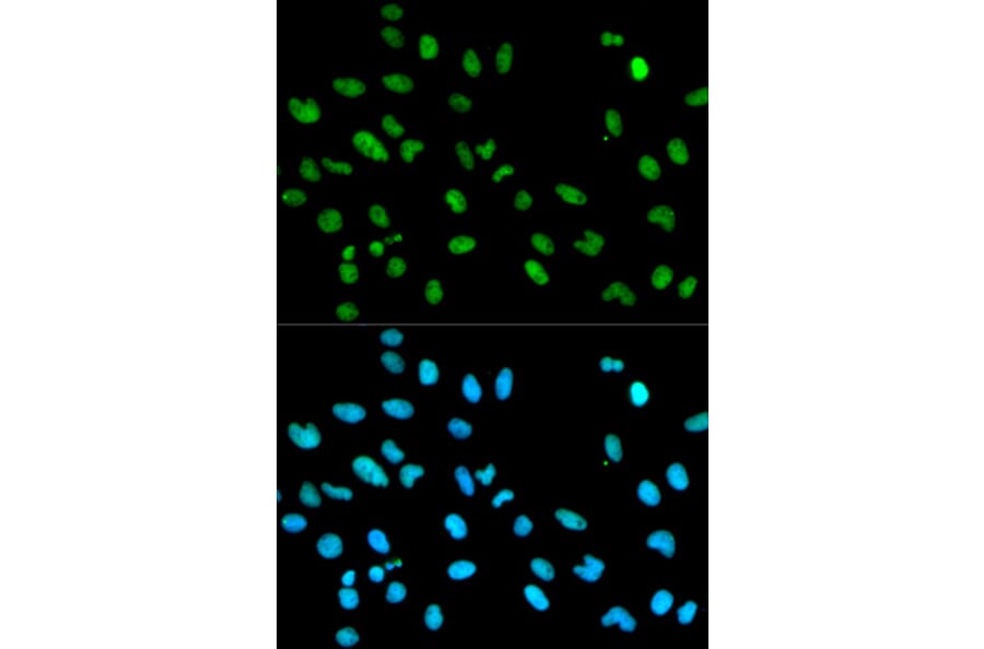 Immunofluorescence - Anti-RBBP4 Antibody (A1490) - Antibodies.com