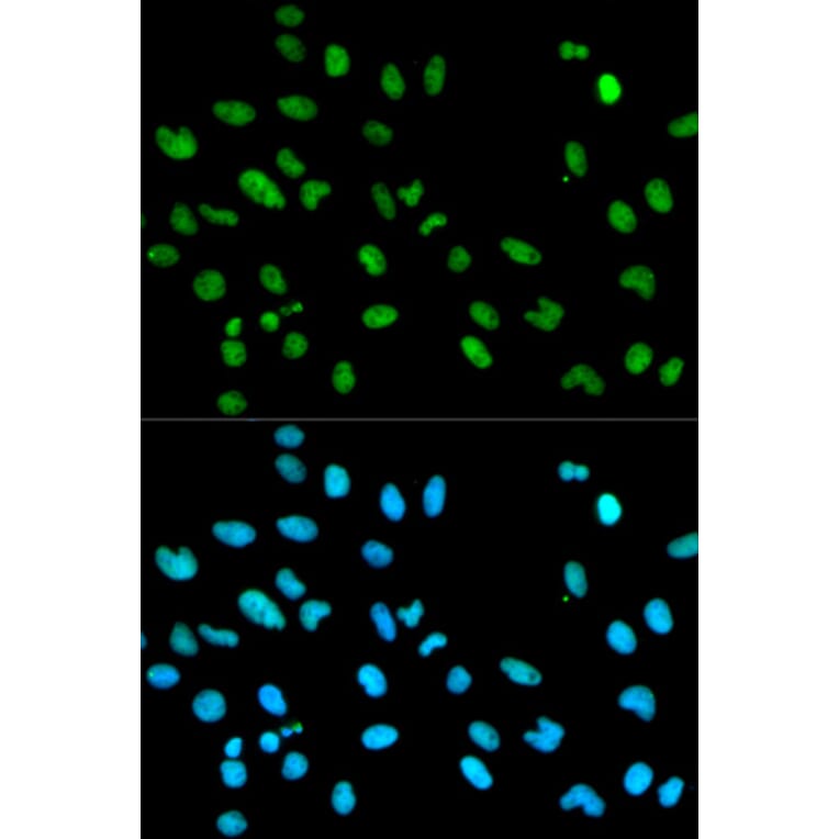 Immunofluorescence - Anti-RBBP4 Antibody (A1490) - Antibodies.com