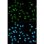 Immunofluorescence - Anti-RBBP4 Antibody (A1490) - Antibodies.com