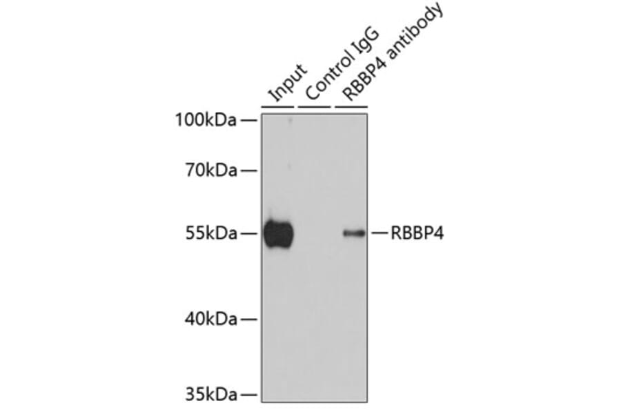 Immunoprecipitation - Anti-RBBP4 Antibody (A1490) - Antibodies.com