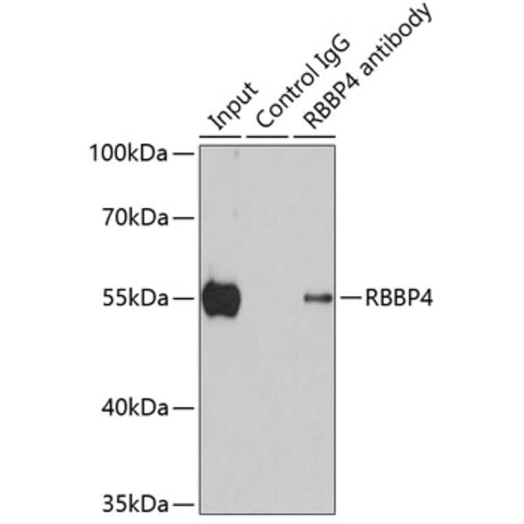 Immunoprecipitation - Anti-RBBP4 Antibody (A1490) - Antibodies.com