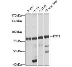 Western Blot - Anti-POT1 Antibody (A13471) - Antibodies.com