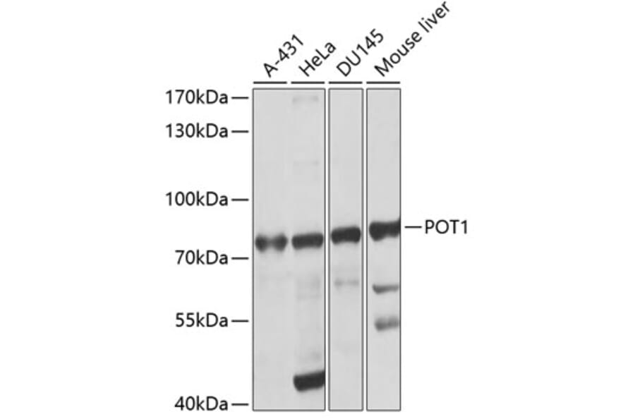 Western Blot - Anti-POT1 Antibody (A13471) - Antibodies.com