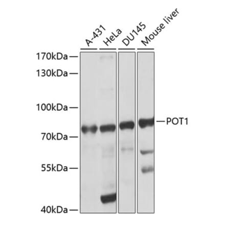 Western Blot - Anti-POT1 Antibody (A13471) - Antibodies.com