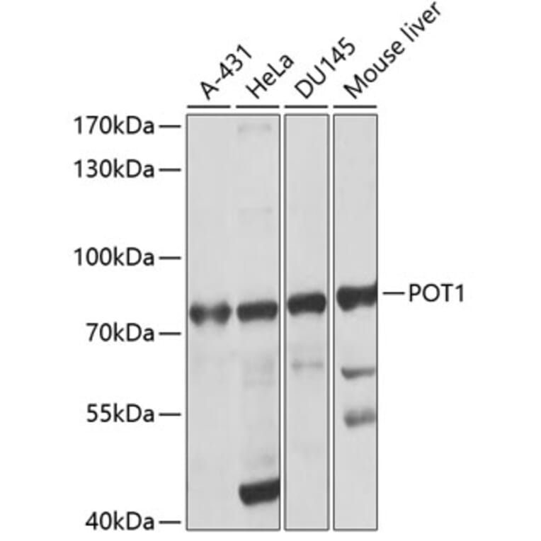 Western Blot - Anti-POT1 Antibody (A13471) - Antibodies.com