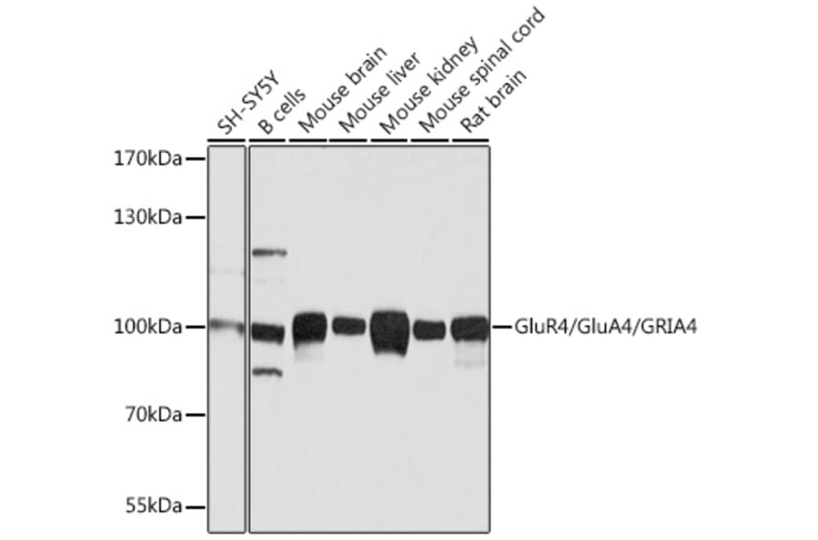 Western Blot - Anti-GluA4 Antibody (A13472) - Antibodies.com
