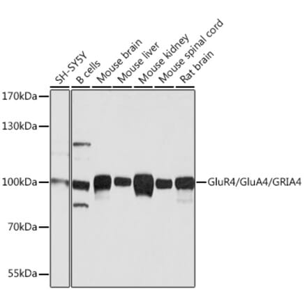 Western Blot - Anti-GluA4 Antibody (A13472) - Antibodies.com