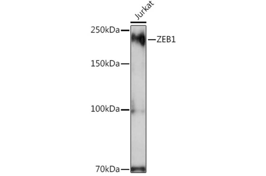 Western Blot - Anti-ZEB1 Antibody (A13473) - Antibodies.com