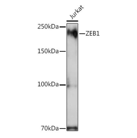 Western Blot - Anti-ZEB1 Antibody (A13473) - Antibodies.com