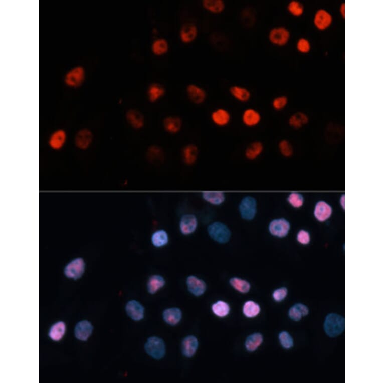 Immunofluorescence - Anti-TET1 Antibody (A13475) - Antibodies.com