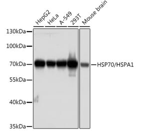 Western Blot - Anti-HSP70 Antibody (A13476) - Antibodies.com