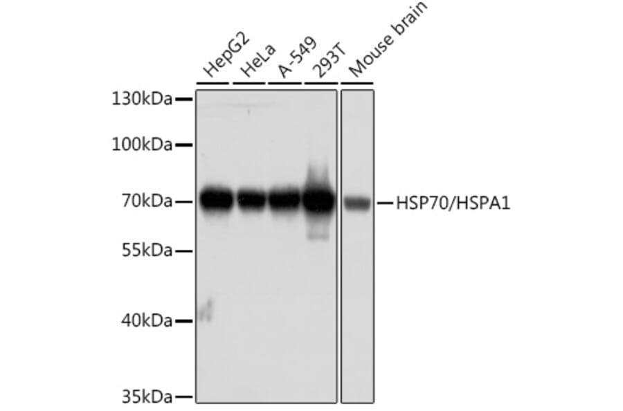 Western Blot - Anti-HSP70 Antibody [AMC0525] (A13476) - Antibodies.com