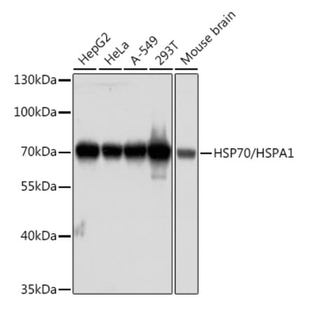 Western Blot - Anti-HSP70 Antibody [AMC0525] (A13476) - Antibodies.com