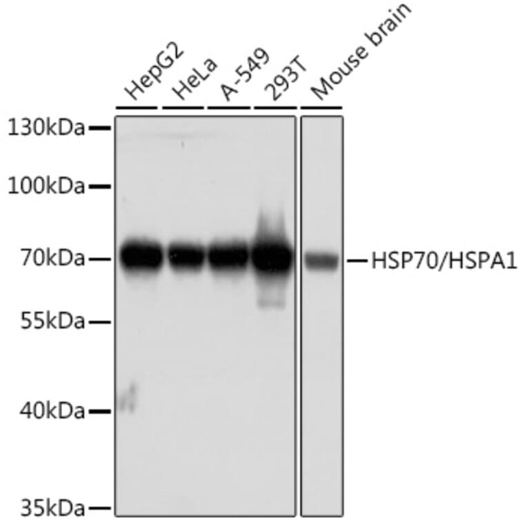 Western Blot - Anti-HSP70 Antibody [AMC0525] (A13476) - Antibodies.com