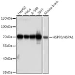 Western Blot - Anti-HSP70 Antibody [AMC0525] (A13476) - Antibodies.com