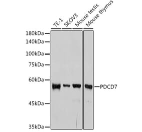 Western Blot - Anti-PDCD7 Antibody [ARC2564] (A13478) - Antibodies.com