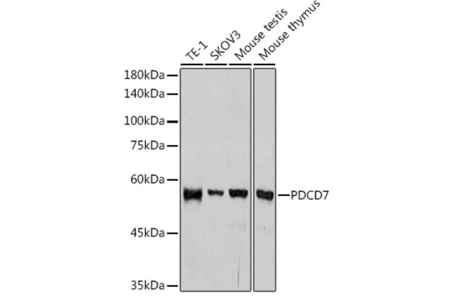 Western Blot - Anti-PDCD7 Antibody [ARC2564] (A13478) - Antibodies.com