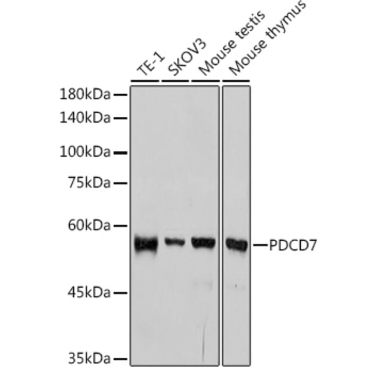 Western Blot - Anti-PDCD7 Antibody [ARC2564] (A13478) - Antibodies.com