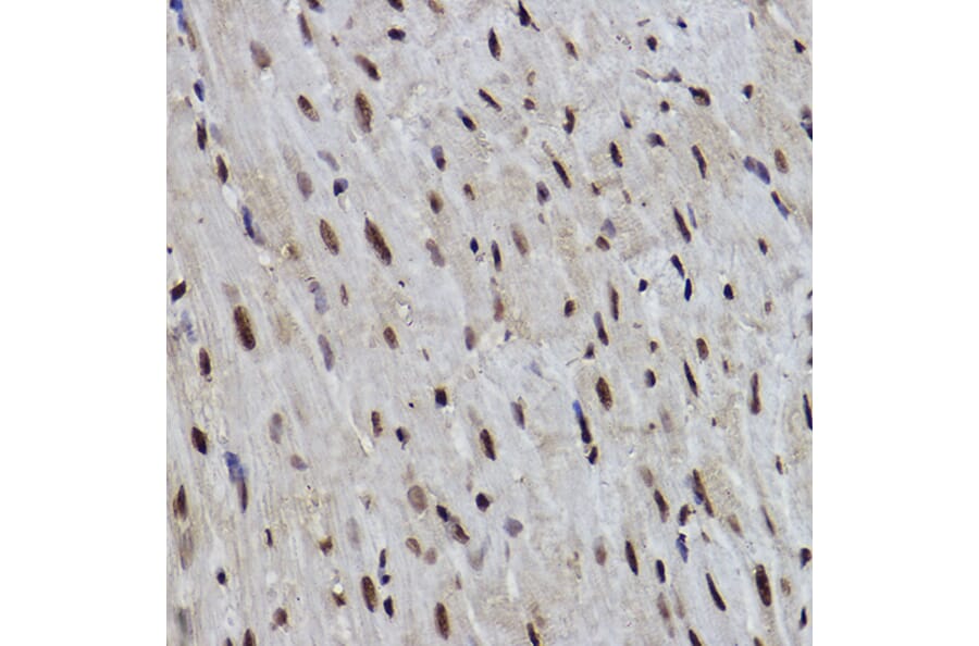 Immunohistochemistry - Anti-PDCD7 Antibody [ARC2564] (A13478) - Antibodies.com