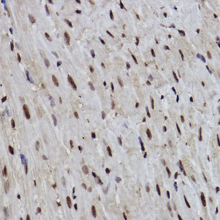 Immunohistochemistry - Anti-PDCD7 Antibody [ARC2564] (A13478) - Antibodies.com