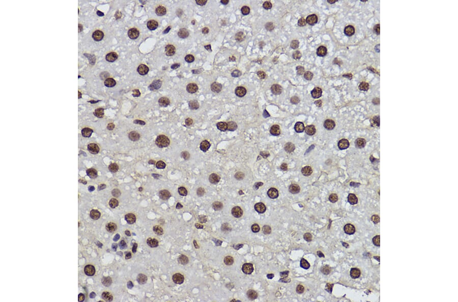 Immunohistochemistry - Anti-PDCD7 Antibody [ARC2564] (A13478) - Antibodies.com