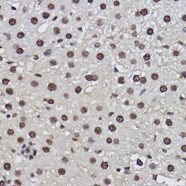 Immunohistochemistry - Anti-PDCD7 Antibody [ARC2564] (A13478) - Antibodies.com