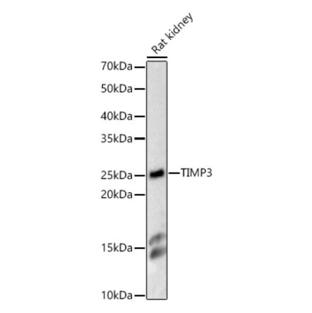 Western Blot - Anti-TIMP3 Antibody (A13479) - Antibodies.com