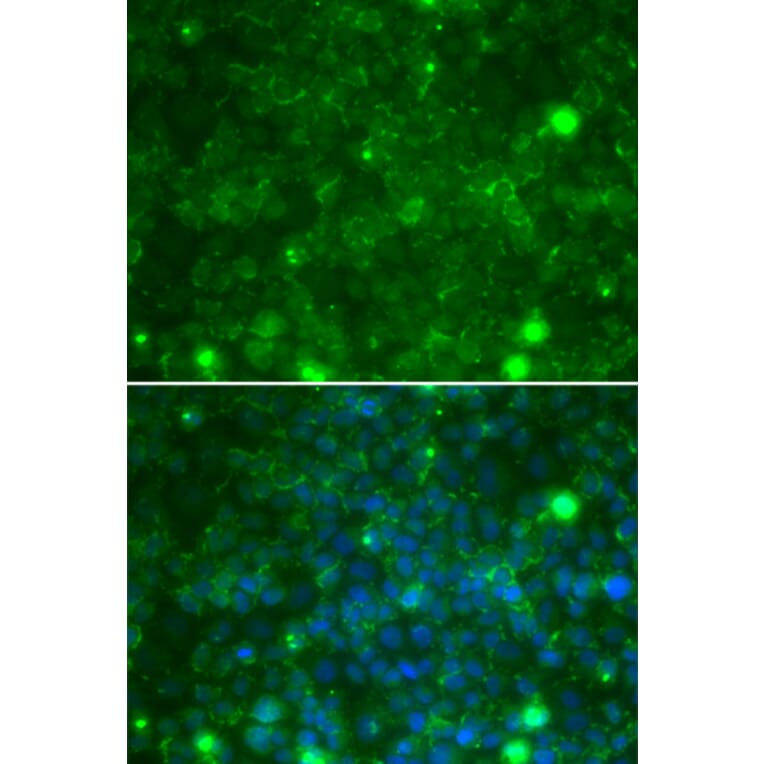 Immunofluorescence - Anti-TIMP3 Antibody (A13479) - Antibodies.com