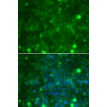 Immunofluorescence - Anti-TIMP3 Antibody (A13479) - Antibodies.com